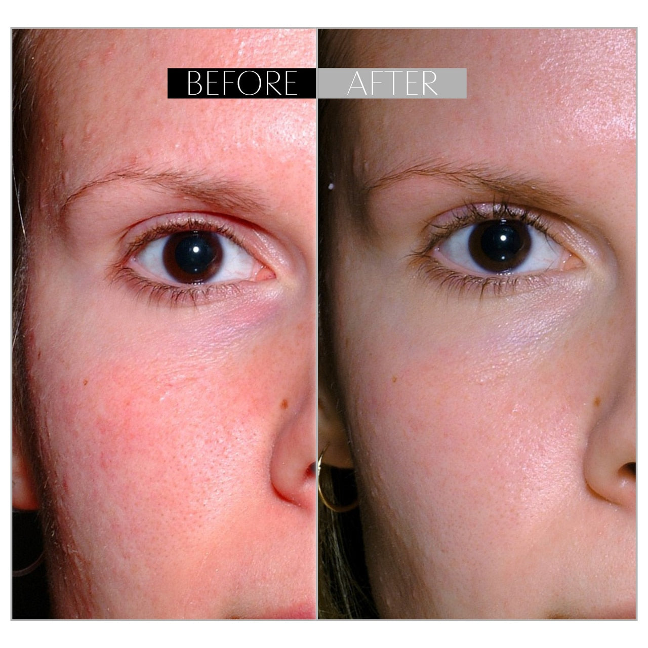 Rice Skin Serum