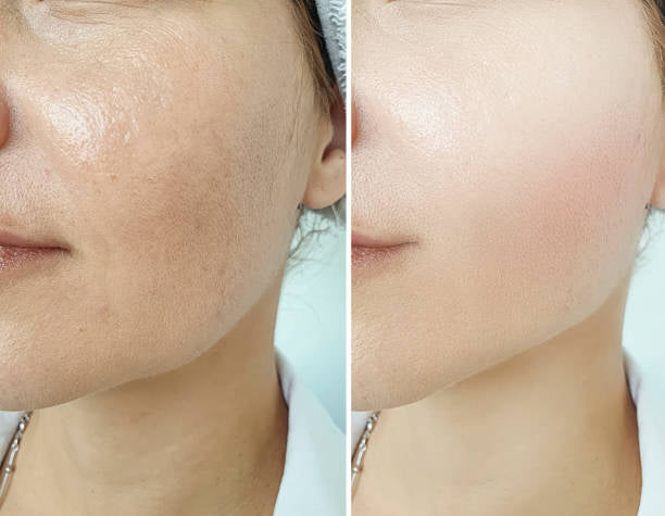 Rice Skin Serum