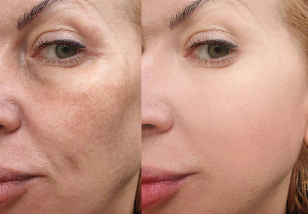Rice Skin Serum