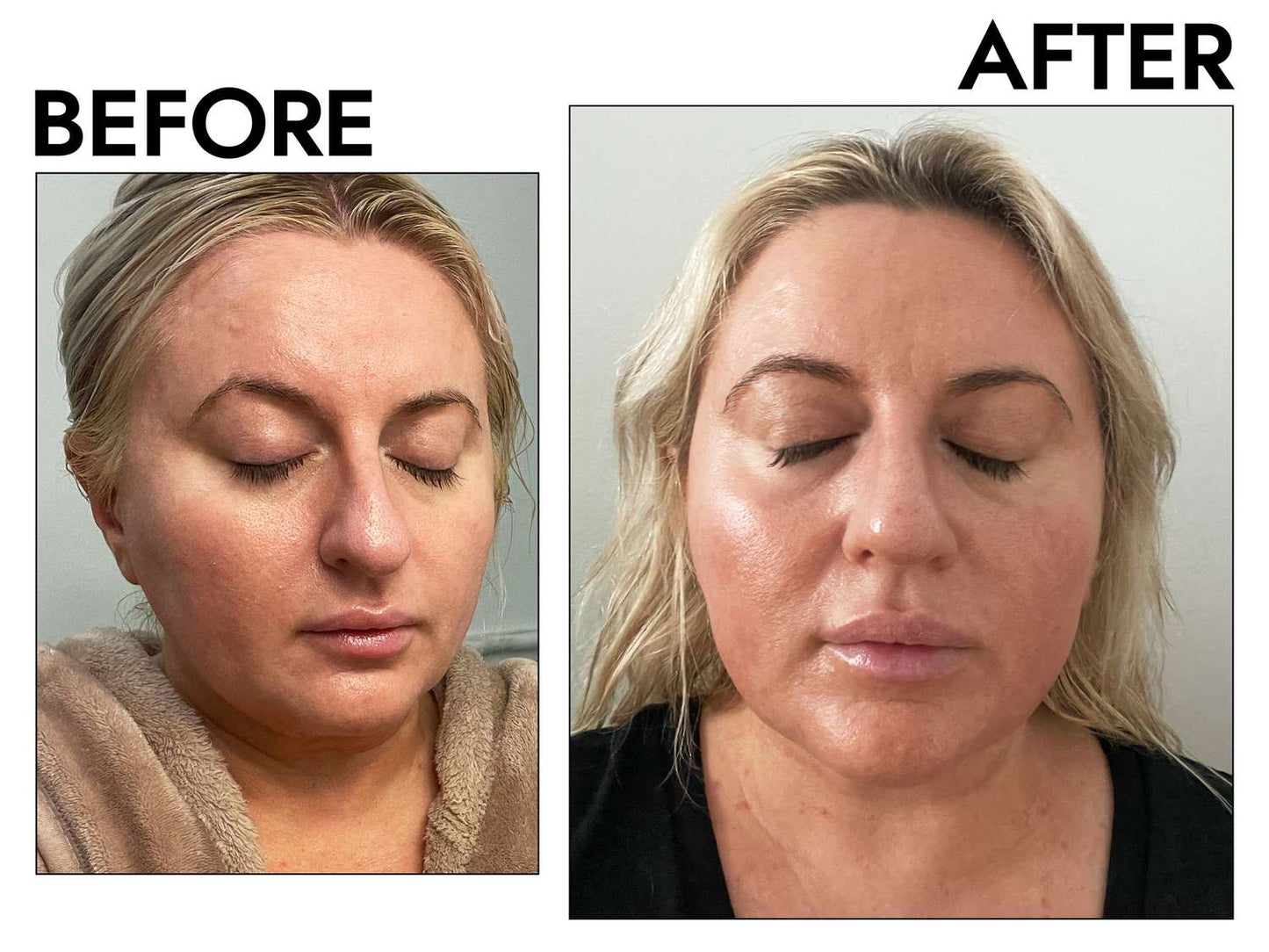 Rice Skin Serum
