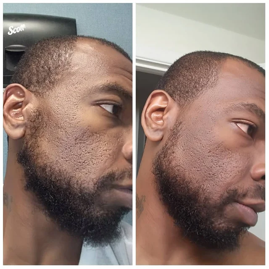 Rice Skin Serum