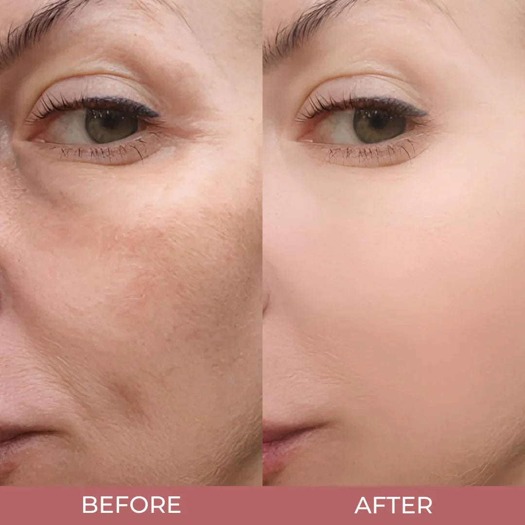 Rice Skin Serum