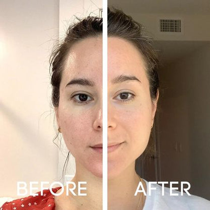 Rice Skin Serum