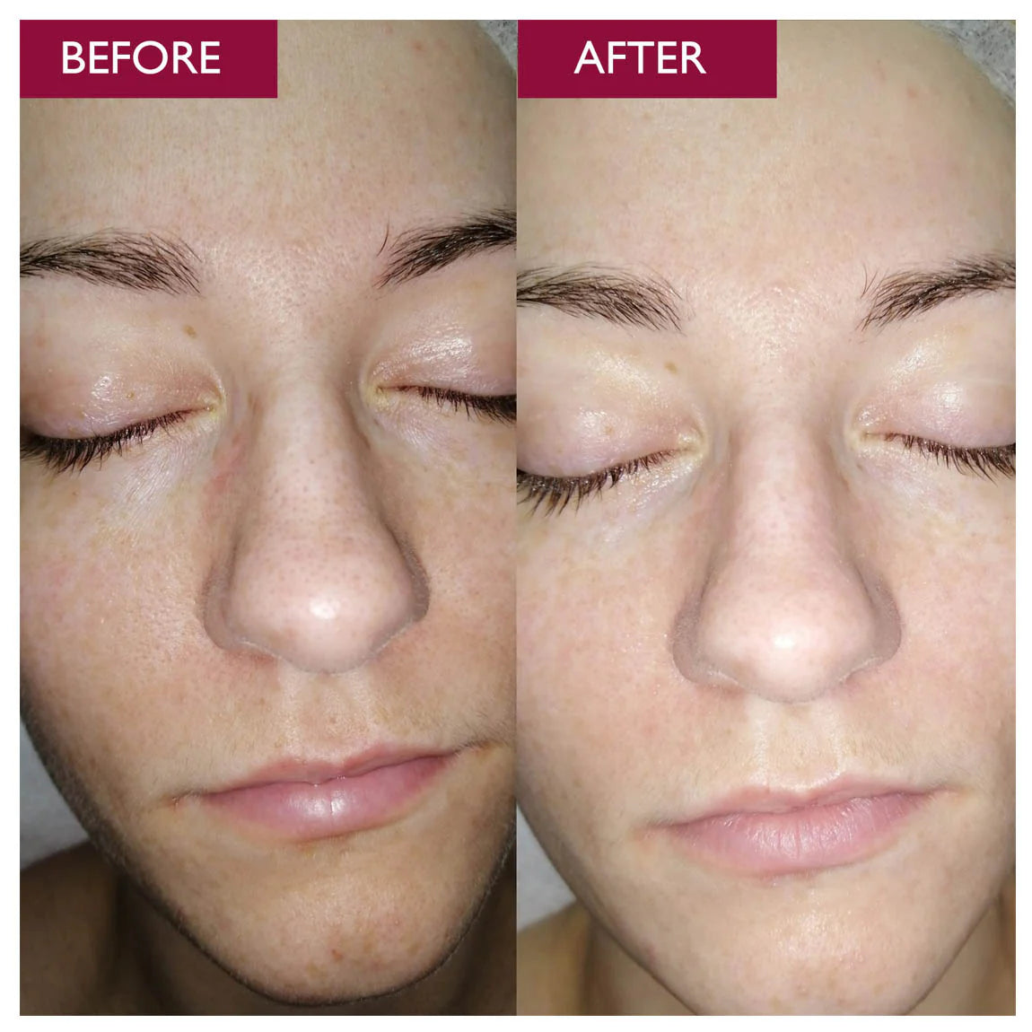 Rice Skin Serum