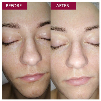 Rice Skin Serum