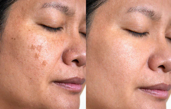 Rice Skin Serum