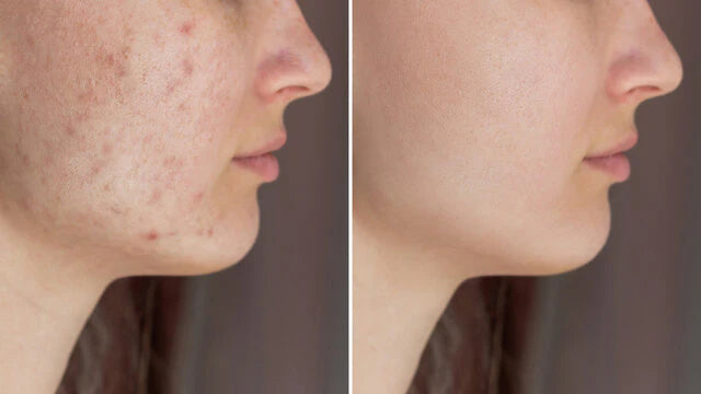 Rice Skin Serum