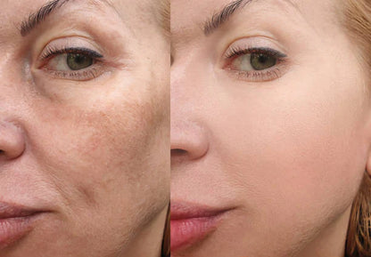 Rice Skin Serum
