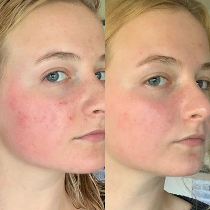 Rice Skin Serum