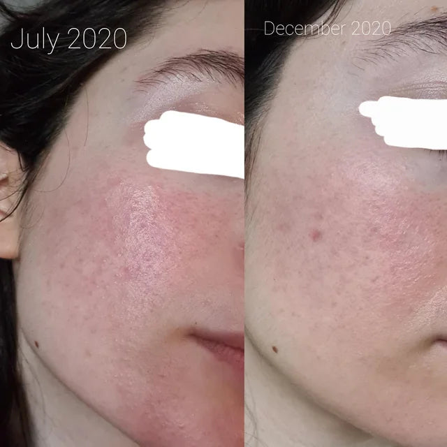 Rice Skin Serum