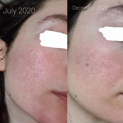 Rice Skin Serum