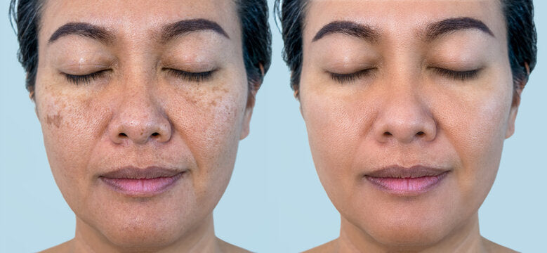 Rice Skin Serum