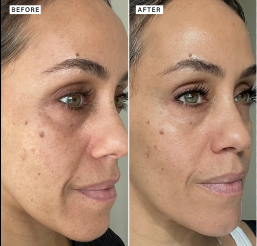 Rice Skin Serum