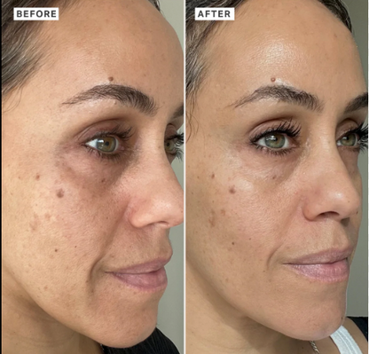 Rice Skin Serum