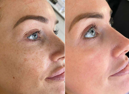 Rice Skin Serum