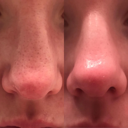 Rice Skin Serum